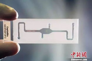 全国320万新生儿接受遗传性耳聋基因筛查 软件开发的关键作用与现代应用